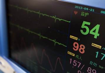A close-up of a screen that is measuring heart rate